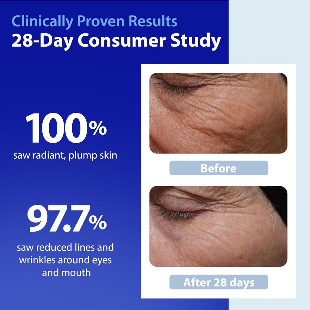 Skinscience Hydroshield Retinol Serum for Face 4 Oz | Dermatologist Tested Hydrating Serum, Contains Retinol and Ceramides for Deep Moisture - Cruelty Free