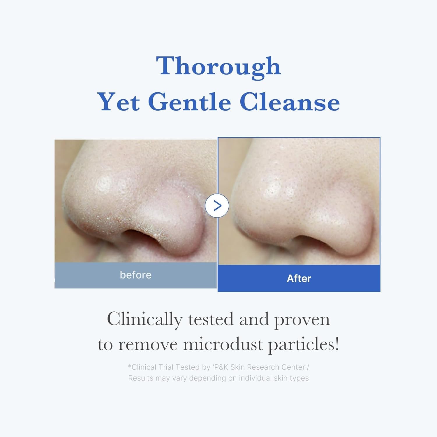 Facial Cleanser Zero Foam Cleanser for Pore & Excess Oil Care | Daily Gentle Cleansing Foam | Excess Sebum Control, Hydration, Pore Minimization | Korean Skincare, Sensitive Skin, 4.23 Oz